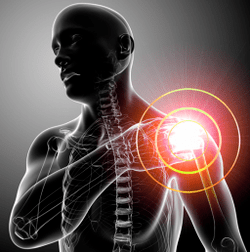 Symptome der Arthrose