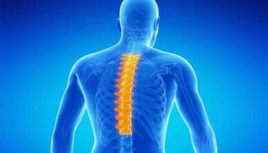 Was ist Osteochondrose der Lendenwirbelsäule